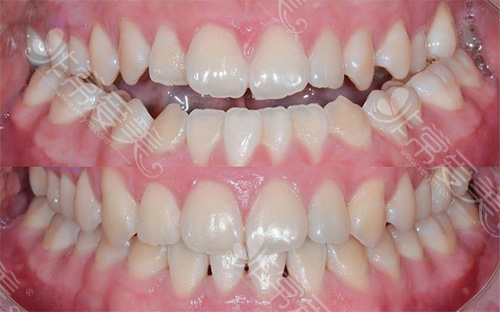 时代天使要反转了？